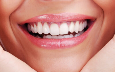 Prolonger la blancheur de vos dents après un traitement esthétique