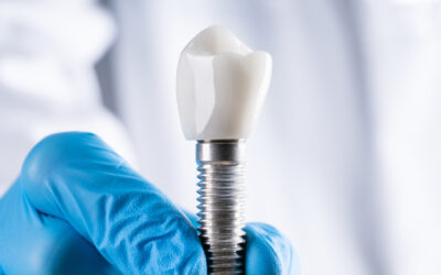 Découvrez la révolution des implants trans-zygomatiques en dentisterie