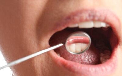 Comprendre la parodontie et son importance pour votre santé bucco-dentaire